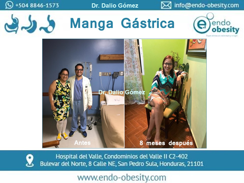 Manga Gástrica